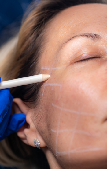 CİLT BAKIMI - KOLAJEN İP PROTOKOLÜ